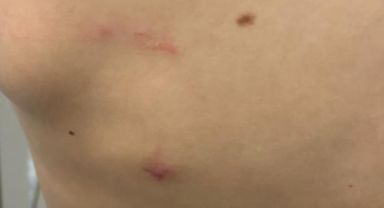 Okul Bahçesindeki Kangal Köpekleri: Öğrenciye Saldırdılar