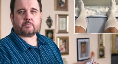 Tıp Dünyasında Şok! Aşırı Alkol Tüketimi Nedeniyle Cinsel Organı Kesilen Adamın Hikayesi