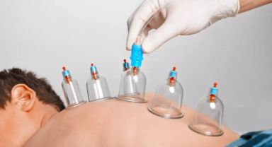 Aile Hekimlerine Hacamat ve Akupunktur Yetkisi Veriliyor