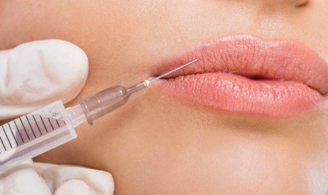 Dudak Dolgusu, İp Askı ve BBL Lazer ile Ameliyatsız Yüz Estetiğine Bütüncül Yaklaşım